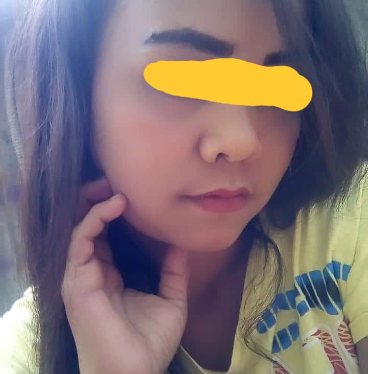 Perempuan M Disebut Dinsos Bukan ODGJ